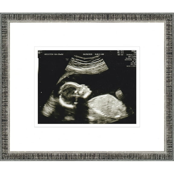 6x5 Rustic Silver Sonogram Frame with White on White Mats with 1 Opening to Display 1 4x3 Sonogram