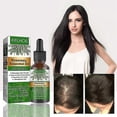 thumbnail image 2 of 1-3 piezas de aceite de romero para el crecimiento del cabello y el cuidado de la piel, nutre el cuero cabelludo, estimula el crecimiento del cabello, mejora la circulación sanguínea 30 ml, 2 piezas, 2 of 5
