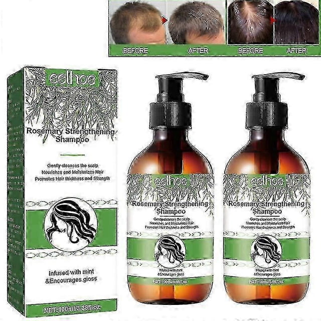 Champú de romero con biotina, 2 unidades, tratamiento para estimular el crecimiento saludable del cabello