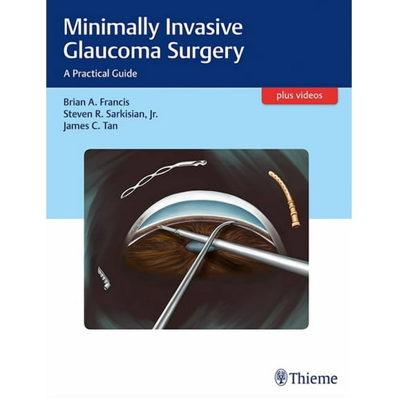 Minimally Invasive Glaucoma Surgery: A Practical Guide (Hardcover)