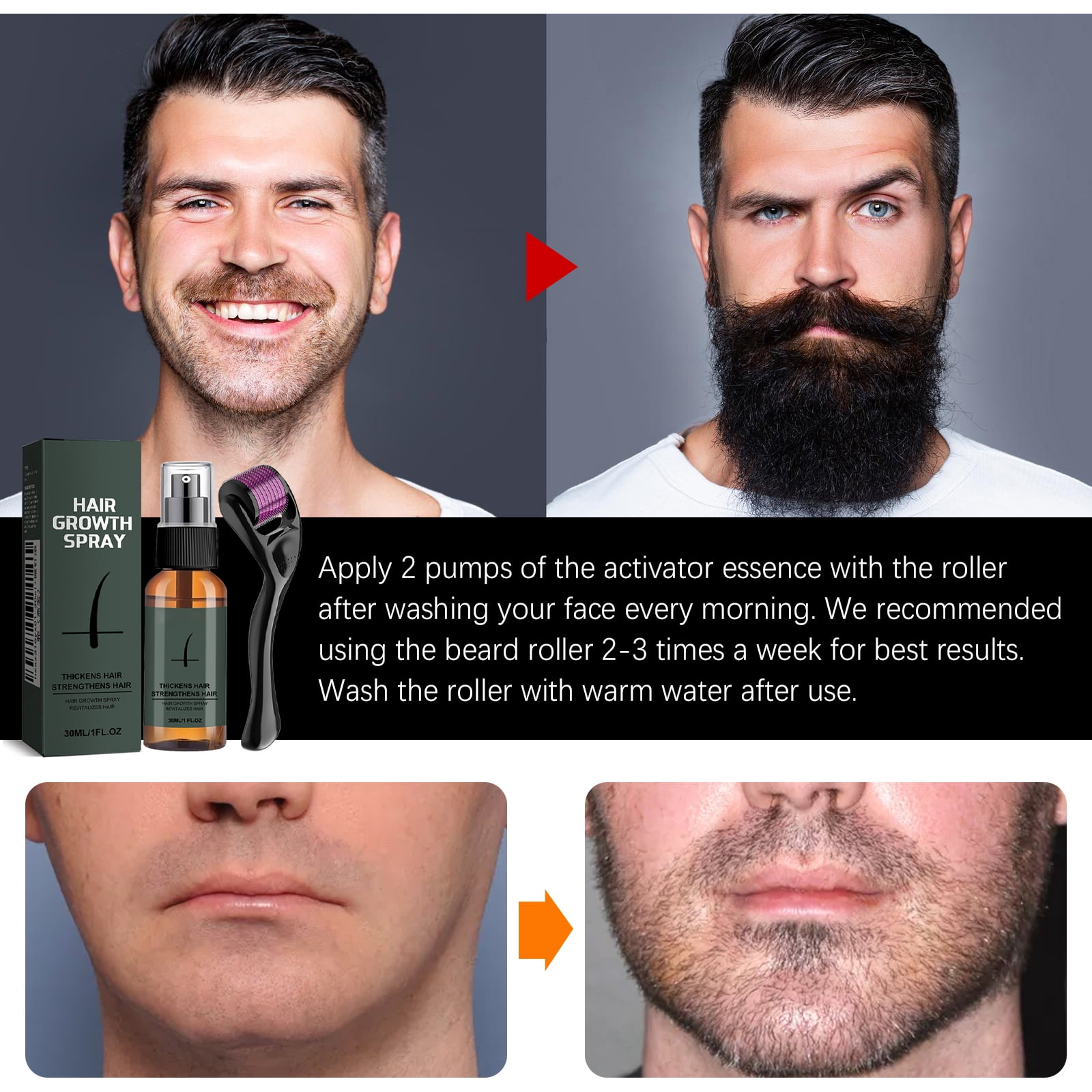 Alvantor Beard Growth Kit, Beard Oil Beard Care for Men, 1fl.oz