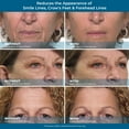 thumbnail image 5 of Plexaderm Rapid Reduction Eye Serum - Advanced Formula Anti Aging Visibly Reduces Under-Eye Bags, Wrinkles, Dark Circles, Fine Lines & Crow's Feet Instantly Instant Wrinkle Remover for Face, 5 of 9
