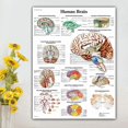 thumbnail image 2 of Anatomical illustration of the human brain poster, canvas, large size. For classrooms, clinics, hospitals, doctors' offices, 2 of 4
