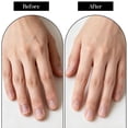 thumbnail image 4 of EXLEAF 3Pcs Mini Cuticle Trimmer,Stainless Steel Cuticle Nail Clippers,Mini Cuticles Cutter Set,Precise Pointed Tip Cuticles Nipper for Manicure,Pedicure,Dry Skin, 4 of 7