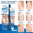 thumbnail image 4 of Wart Remover Paste,Fast-Acting Wart Paste And Paste For All Types Of Warts, Lotion Wart Set,Easy Application, 4 of 5