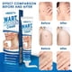 thumbnail image 4 of Wart Remover Paste,Fast-Acting Wart Paste And Paste For All Types Of Warts, Lotion Wart Set,Easy Application, 4 of 4