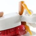 thumbnail image 4 of keepw Realistic Appearance Lumbar Vertebrae Model Durable And Reliable white 1Set, 4 of 6