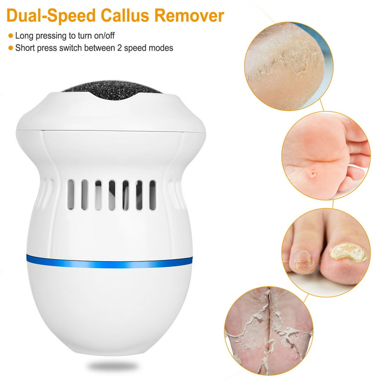 Callusfune™ - The Foot Callus Remover, Smooth Pedicure Wand for Feet,  Electric Callus Removers for Feet, USB Rechargeable 2-Speed Adjustment to  Remove Calluses Microdermabrasion Pedicure