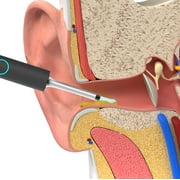 Bebird W3 Ear Cleaning Otoscope, Blue: 5 Attachments, 1080P Camera: Wireless Connection