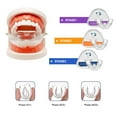 thumbnail image 3 of Adults Alignment Bruxism Invisible Teeth Corrector 3 Stage Tooth Retainer Tooth Tray 2 STAGE-KIDS, 3 of 8