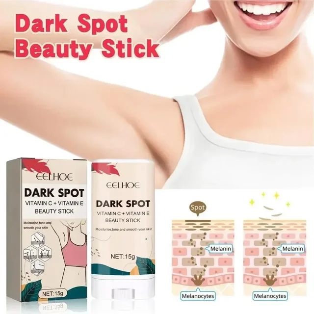 Crema blanqueadora para axilas, eliminador y Corrector de manchas oscuras, crema suave y segura para aclarar la piel, crema blanca para las axilas y el cuello