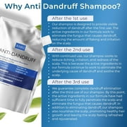 Anti Dandruff Shampoo Anti Fungal Dandruff Mens Shampoo | Medicated, Clarifying, Psoriasis & Biotin Shampoo