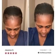 thumbnail image 5 of TRU Balance Hair Care Follicle Booster-Bald Spot & Hair Loss Treatments for Women & Men, 5 of 5
