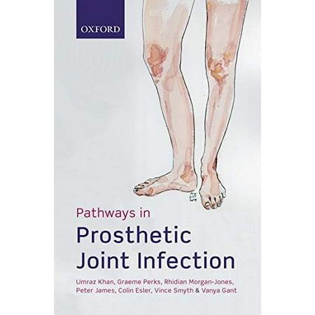 Pathways in Prosthetic Joint Infection | Walmart Canada