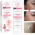 thumbnail image 2 of RtopR-Crema para el tratamiento del acné, Gel reparador de puntos negros, Control de aceite, reduce los poros, blanqueamiento de cicatrices, hidratante, Cosméticos coreanos, cuidado de la piel"one" Fivean LED, 2 of 2
