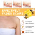 thumbnail image 4 of Spray 3Pcs Body Scar Removal Spray Stretch Mark Diminishing Spray Skin Smoothing Moisturizing Spray 20g, 4 of 8