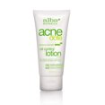 thumbnail image 1 of Alba Botanica Acnedote Oil Control Loción Natural (1x2 Oz), 1 of 1