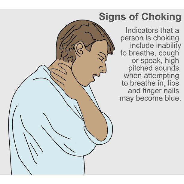Signs of Choking Poster Print by Gwen ShockeyScience Source