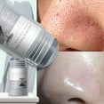 Deep Blackhead Removal Videos 2023 - 0fasbct