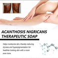 thumbnail image 4 of 1pc Jaysuing Underarm Whitening Soap Deep Cleansing And Repairing Dark Skin Black Acanthopsia Moisturizing Whitening Skin Soap, 4 of 4