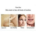 thumbnail image 3 of Derma Wand, Anti-aging Face - Rf Beauty Instrument Massage Eu Plug, 3 of 4