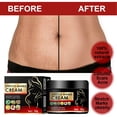 thumbnail image 4 of Scar Healing Cream, Tightening Skin Scar Repair Cream  for Burns, 4 of 8