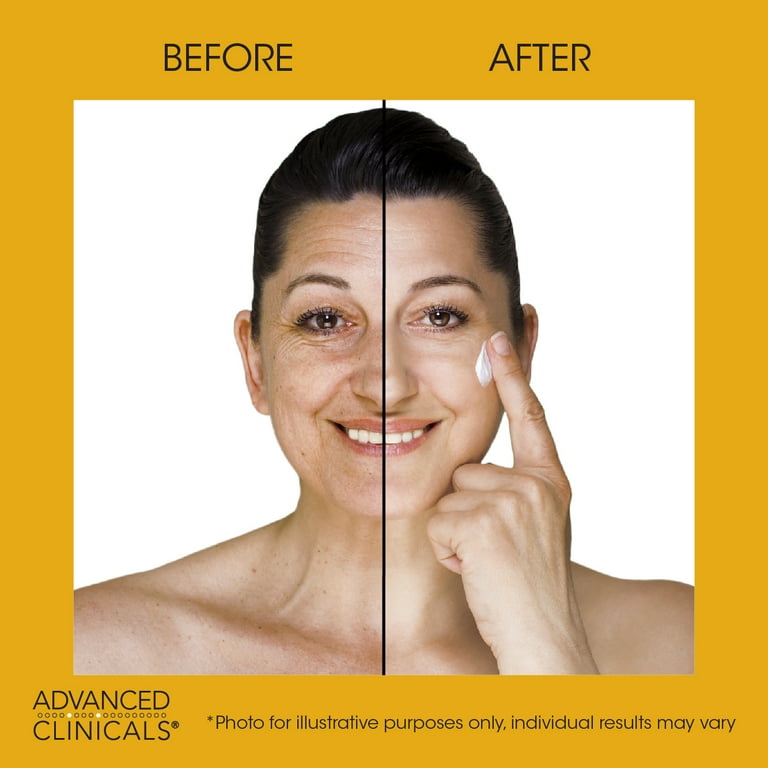 Advanced Clinicals Retinol Body Lotion, Face Lotion & Body Cream