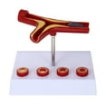 thumbnail image 1 of Modelo médico de aterosclerosis Modelo anatómico de vasos sanguíneos Modelo cardiovascular, 1 of 6