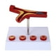 thumbnail image 1 of WORGEOUS Modelo médico de aterosclerosis Modelo anatómico de vasos sanguíneos Modelo cardiovascular, 1 of 9