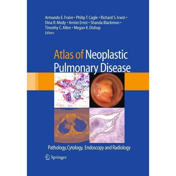 Atlas of Neoplastic Pulmonary Disease: Pathology, Cytology, Endoscopy and Radiology, (Hardcover)