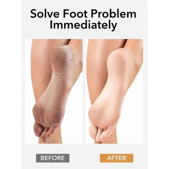 Foot File & Callus Remover – Two Sided Coarse and Fine Pedicure Tool with Non Slip Handle, Washable Foot Rasp for Dead Skin Removal, Cracked Heel Care, Home Spa & Travel Foot Care