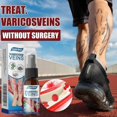 thumbnail image 2 of Varicose Vein Massage Spray for South Moon - Say Goodbye to Leg Discomfort, 2 of 5