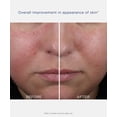 thumbnail image 4 of Gel hidratante facial NEOSTRATA Mandelic Clarifying, 4 of 9