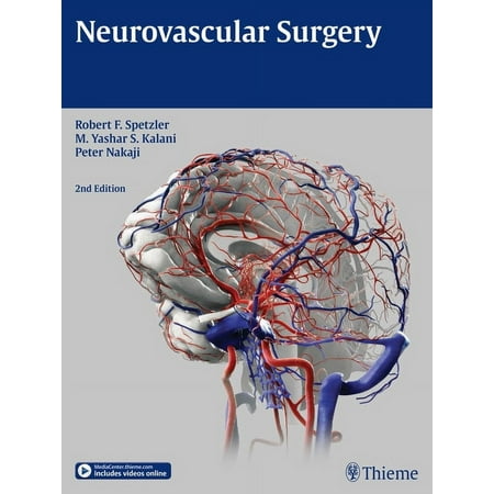 UPC: 9781604067590 | Neurovascular Surgery (Hardcover)