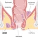 thumbnail image 4 of Crema de cuidado perianal LMNOOP, cicatrización rápida, heridas, fisuras del ano, 4 of 9