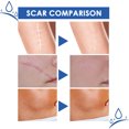 thumbnail image 3 of Stretch Mark Cream, Skin Repairing Cream 2pcs Herbal Extract  for Travelling, 3 of 8