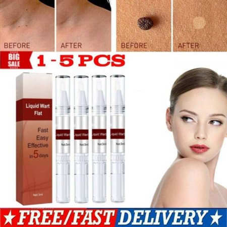New Wipe Off Skin Tags & Moles Removal Quick Safe Remover Restore Skin 1-5pcs