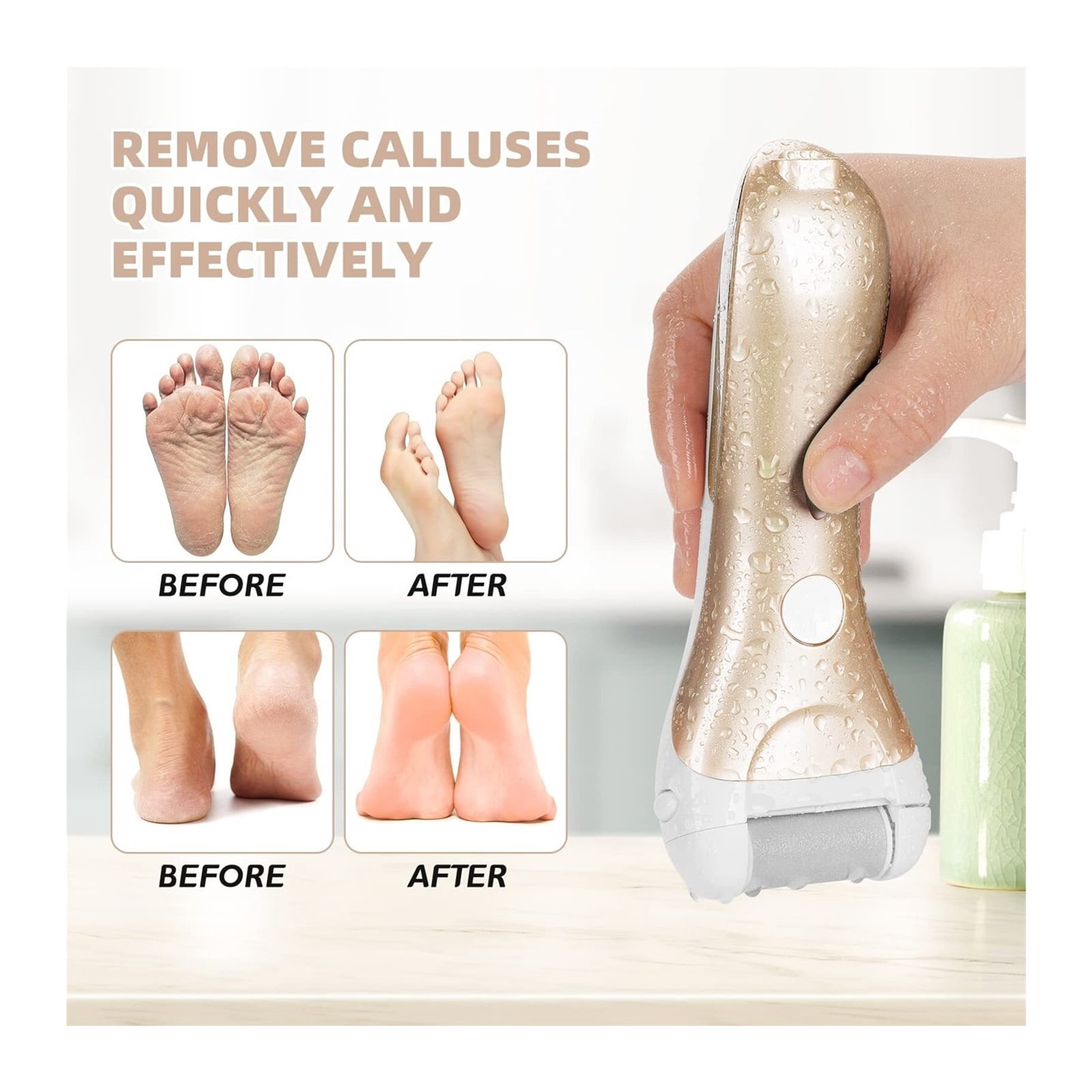 Electric Callus Remover for Feet with Vacuum, Premium Portable Pedicure Tools Rechargeable Waterproof 2 Speed Foot File Scrubber Callus Remover Tool Foot Care kit(Black)