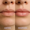 thumbnail image 4 of Lip Repair 5g, 4 of 4