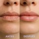 thumbnail image 4 of Lip Repair 5g, 4 of 4