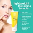 thumbnail image 2 of Crema en gel para Acne Touch con peróxido de benzoilo al 2,5%, 240 ml, 2 of 7