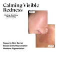 thumbnail image 3 of Serum MATKAS, eliminador de manchas oscuras coreano para rostro, 3 of 7
