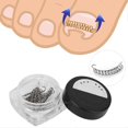 thumbnail image 2 of 2pcs Ingrown Toenail Fixation Wire Pedicure Care Tool, 2 of 2