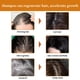 thumbnail image 4 of Champú de Arroz para Cabello Nutritivo (100 Ml) | Crecimiento Natural, Biotina y Cafeína, Aceite Nutritivo | Fórmula Espesante | Seguro para Todo Tipo de Cabello | 1 Champú de Arroz para Cabello, 4 of 7