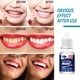 thumbnail image 5 of 10 ml Blanqueamiento dental Limpieza Cuidado dental Limpieza dental Agua blanqueadora Solución de limpieza dental, 5 of 5