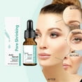 thumbnail image 1 of Esencias acondicionadoras de poros Essence Elimina puntos negros y suaviza 10 ml en ursing, 1 of 9