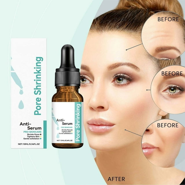 Esencias acondicionadoras de poros Essence Elimina puntos negros y suaviza 10 ml en ursing