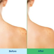 Differin Acne-Clearing Body Wash with 2% Salicylic Acid, Cream-to-Lather Cleanser, Back & Chest Acne Treatment, Daily Use, 10 fl oz