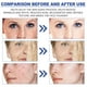 thumbnail image 3 of Suero Facial ANGGREK Suavizante Aumenta La Elasticidad 3 Piezas 30 Ml, 3 of 7