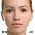 thumbnail image 2 of Sérum antienvejecimiento Catkin Phoenix de Cushion Foundation, color beige claro, 2 of 9
